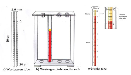 Westergren's Tube and Wintrobe Tube